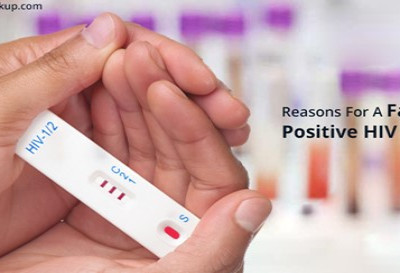 Bốn lý do chính khiến xét nghiệm HIV dương tính giả