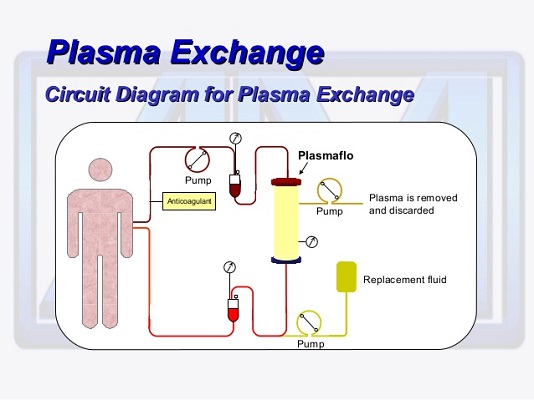 plasma1